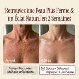 Avant / Après